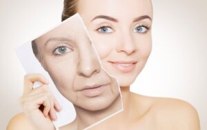 Common Misconceptions about Dermatology Debunked