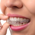 What To Expect From Your Orthodontic Treatment Journey