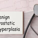 The Urologist’s Role In The Treatment Of Benign Prostatic Hyperplasia