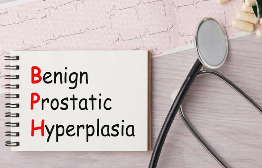 Treatment Of Benign Prostatic Hyperplasia