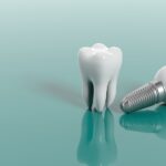 Your All-in-One Guide to Dental Implants in West Houston